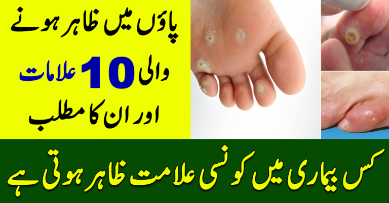 10 Signs in Feet and Their Indications